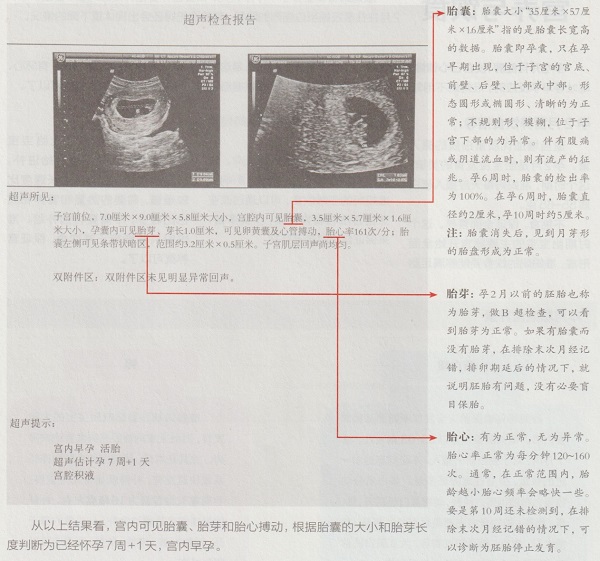 怀孕2个月要做产检吗？(图2)