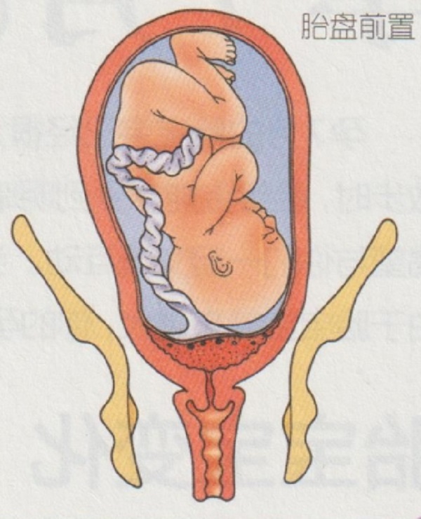 怀孕六个月的常见不适如何用药?(图2)