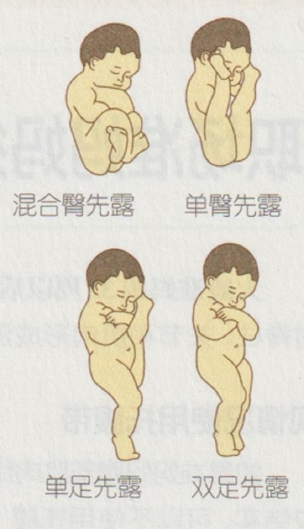孕8月准妈妈的保健有哪些地方需要注意（2）(图3)