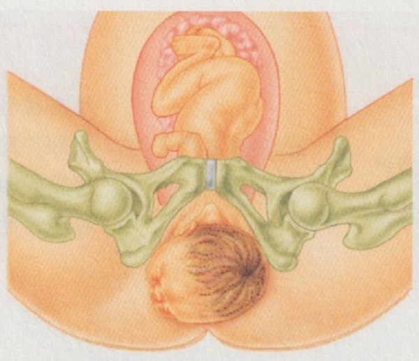 准妈妈分娩前需要准备什么？（2）(图2)